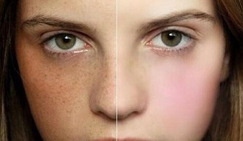 雀斑网红吃瓜,揭秘娱乐圈幕后真相